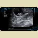 Ultrasounds of Baby Mortimer