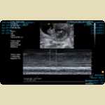 Ultrasounds of Baby Mortimer -  2 of 11