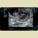 Ultrasounds of Baby Mortimer -  3 of 11