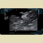 Ultrasounds of Baby Mortimer -  5 of 11