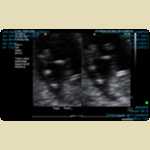 Ultrasounds of Baby Mortimer