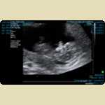 Ultrasounds of Baby Mortimer -  10 of 11