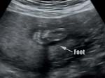 Baby Mortimer Ultrasounds