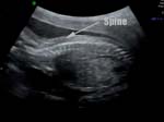 Baby Mortimer Ultrasounds